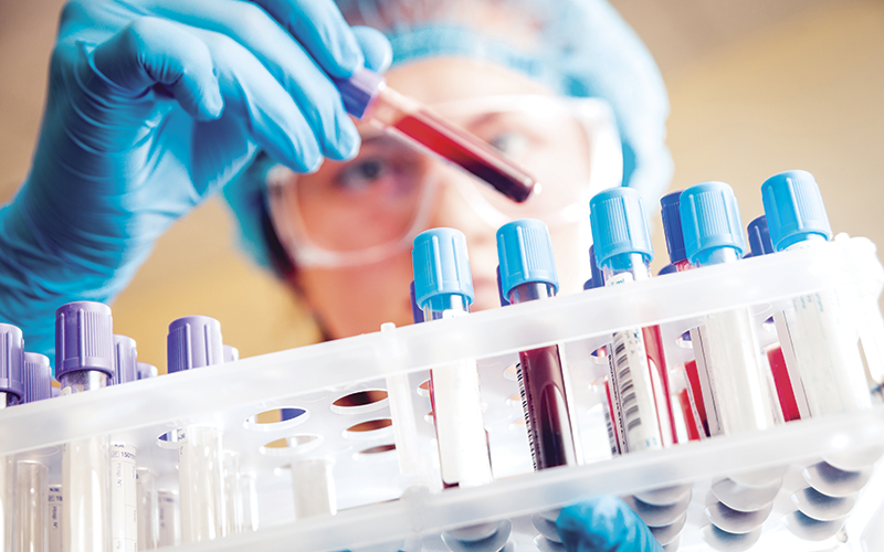 Blood test Blood test