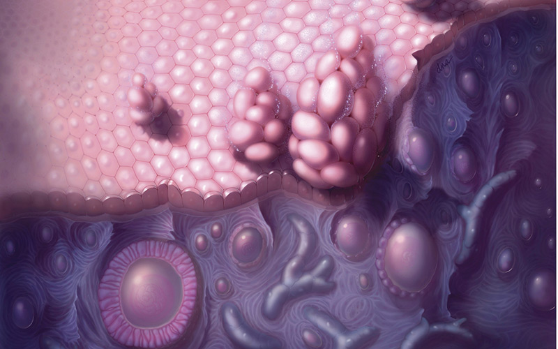 Markers Biomarker Protein in Ovarian Cancer Sciencephoto
