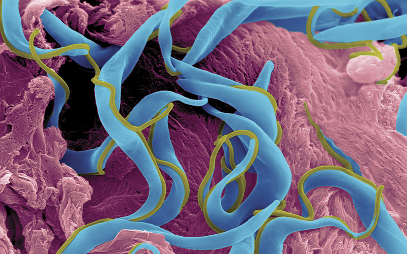 supporting research trypanosome trypomastigote protozoan