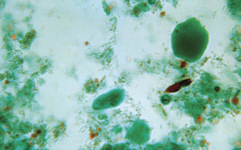 How to Trichome Staining Getty