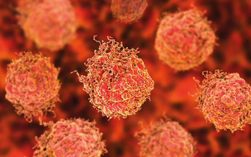  p10-13-news-prostate-cancer-science-photo-library-f0202638.jpg