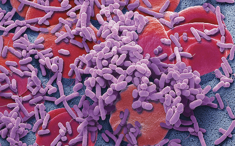 Sepsis Science Photo Library
