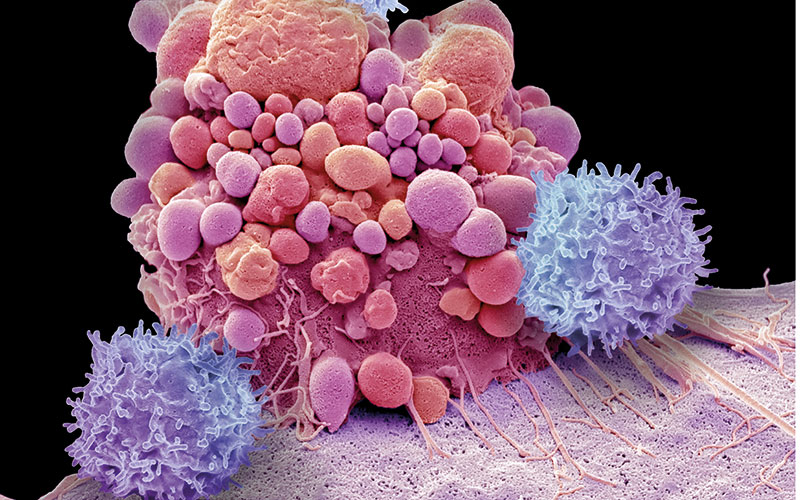 p8-13-news-car-t-cell-therapy-science-photo-library-c0388808.jpg