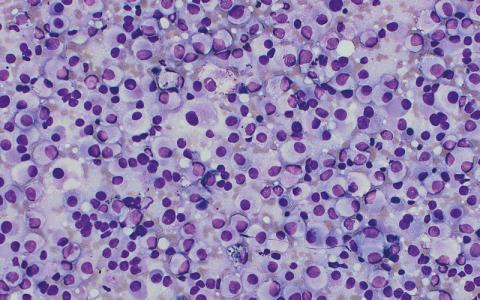 cytopathology - CREDIT - Leonie-Wheeldon-21