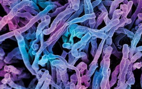 actinomyces viscosus bacteria CREDIT - science photolibrary