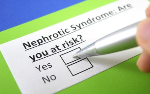 nephrotic syndrome you yes CREDIT - shutterstock -639997780