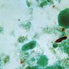 How to Trichome Staining Getty