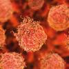  p10-13-news-prostate-cancer-science-photo-library-f0202638.jpg