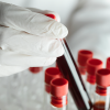 web_blood-testing_credit_istock-1384651794.png