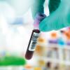 Technician holding a blood sample ready for testing with other human medical samples in the background.-Image credit - Science-Photo-Library-f0243823