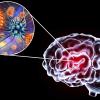 viral encephalitis 3d illustration showing brain CREDIT- Kateryna-Kon - shutterstock - 695144830