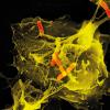 neutrophil cell trapping bacteria Image Credit | Science Photo Library-p2760184