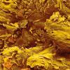 Coloured scanning electron micrograph (SEM) of delamination of a toenail after a fungal infection. Science Photo Library-c0585410.jpg