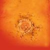 melanoma cell - CREDIT - science-photolibrary-f0403499