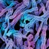 actinomyces viscosus bacteria CREDIT - science photolibrary