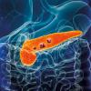 Pancreas or pancreatic cancer with organs and tumors or cancerous cells 3D rendering illustration with male bodyImage Credit | istock-1467893187
