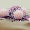 Natural-killer cells attacking a cancer cel - CREDIT - Science-Photolibrary-f0339843