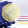 The rise of antibiotic-resistant bacterial infections . CREDIT- istock-1495083577