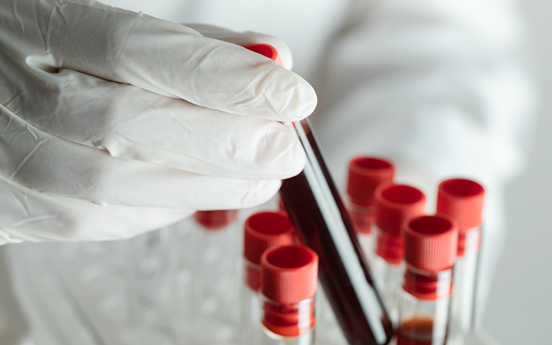 web_blood-testing_credit_istock-1384651794.png