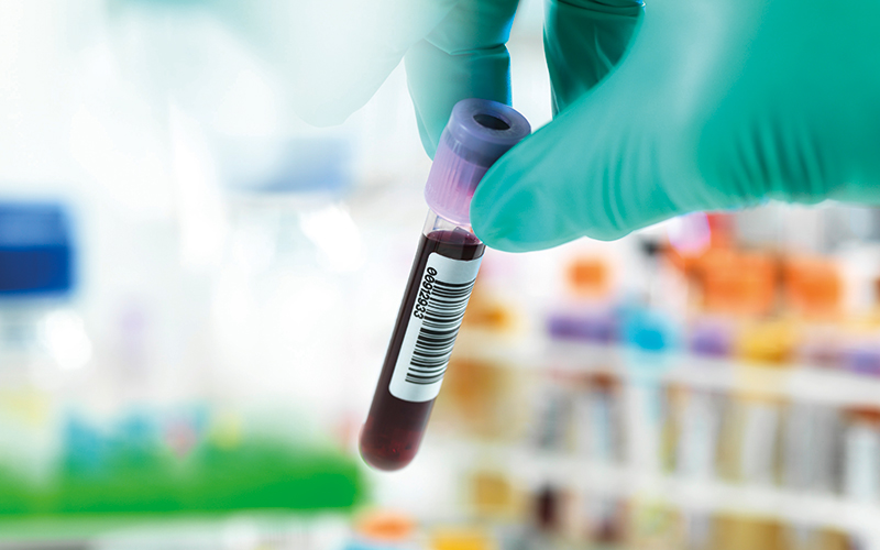 Technician holding a blood sample ready for testing with other human medical samples in the background.-Image credit - Science-Photo-Library-f0243823