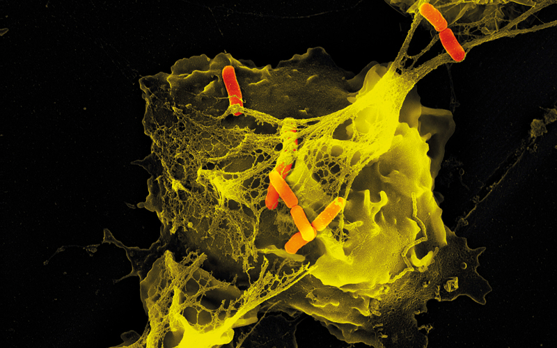 neutrophil cell trapping bacteria Image Credit | Science Photo Library-p2760184