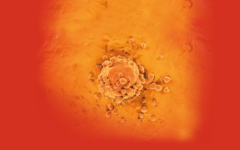 melanoma cell - CREDIT - science-photolibrary-f0403499