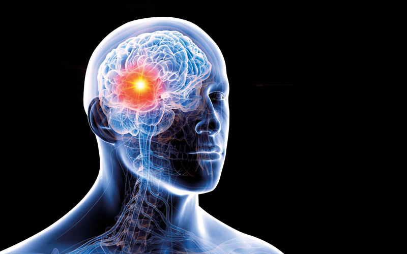brain tumour CREDIT_science photo library