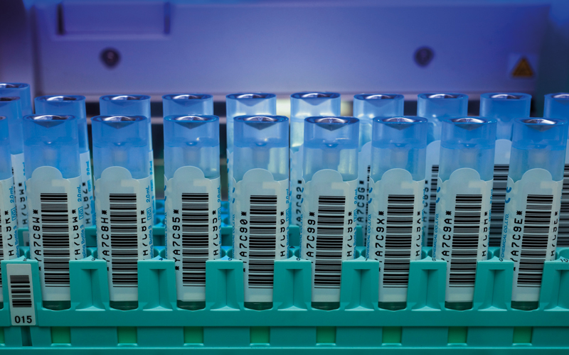 automated testing for bowel cancer_CREDIT_science-photo-library_c0094929