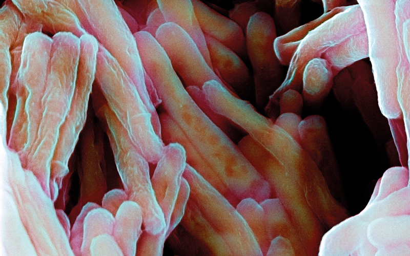 Tuberculosis vaccine bacteria-Image Credit | Science Photo Library - b2201433