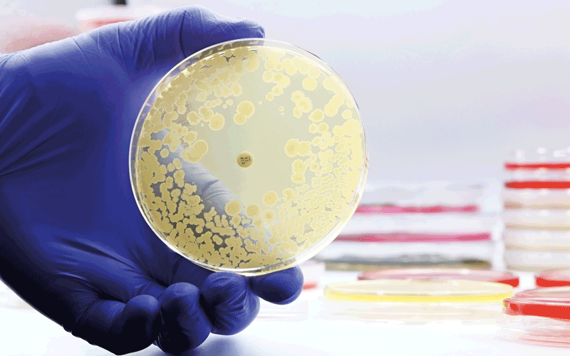 The rise of antibiotic-resistant bacterial infections . CREDIT- istock-1495083577